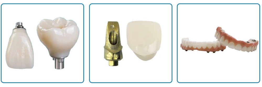 Precision-milled custom implant abutment and Straumann certified crown fabricated at SeaBrook Dental Lab in Lynnwood